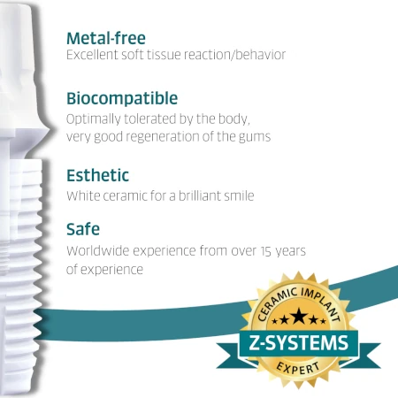 Ceramic Implant Informational Image Ceramic Implant Informational Image